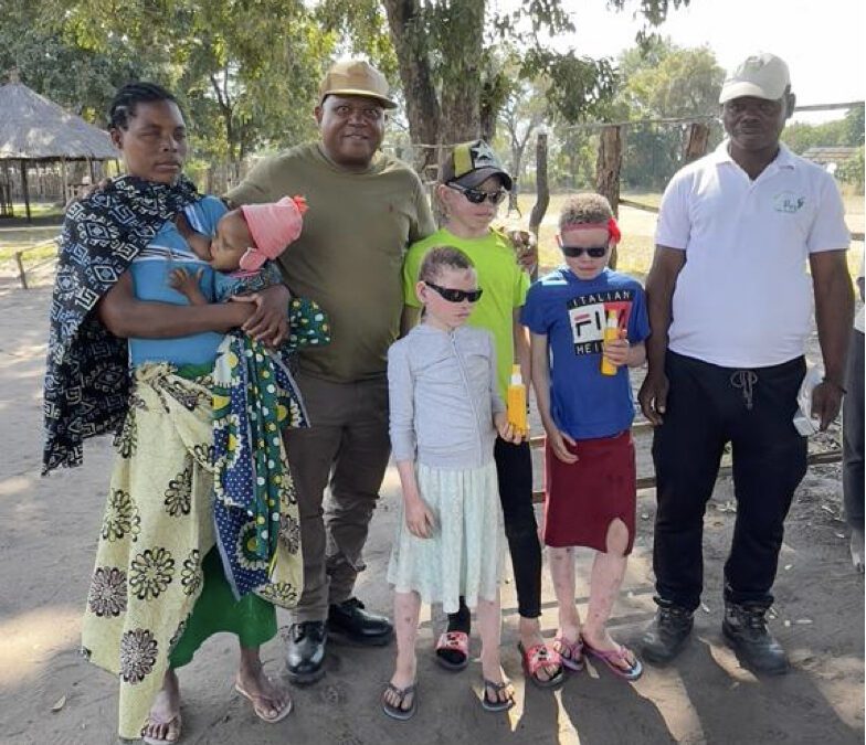 Gorongosa Park partners with Kanimambo to provide sun protection for local youth.